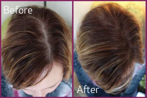 how to regrow hair due to stress